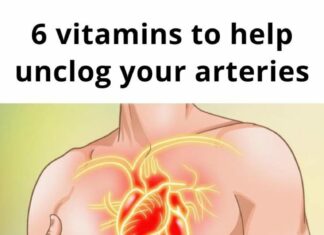 6 vitamins that can help with clogged arteries