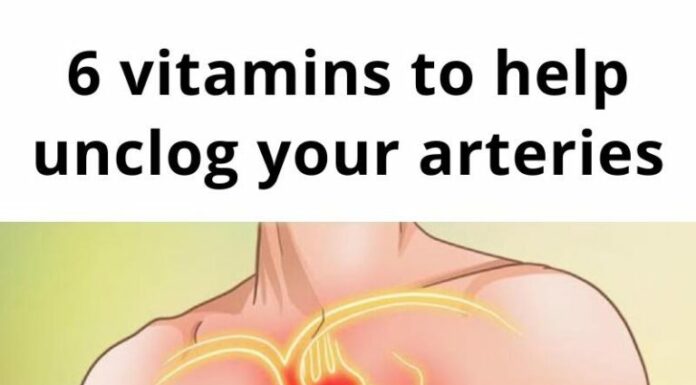 6 vitamins that can help with clogged arteries
