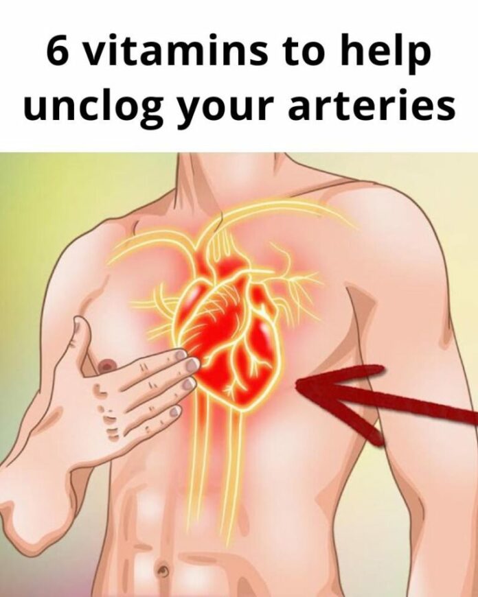 6 vitamins that can help with clogged arteries