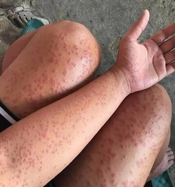 I spent a couple of nights at my friend’s previous apartment and saw these unusual bumps