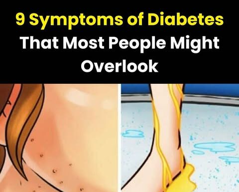 Could You Have Diabetes? 9 Symptoms Many Overlook in Their 20s and 30s