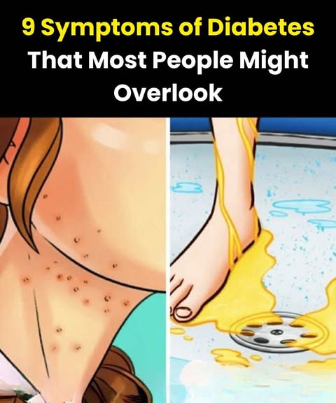 Could You Have Diabetes? 9 Symptoms Many Overlook in Their 20s and 30s