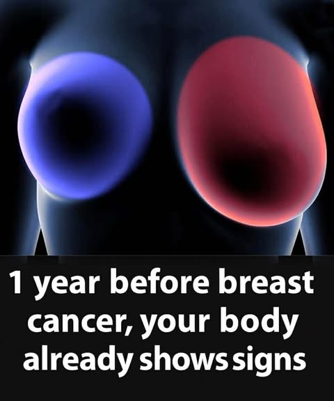 Breast Cancer: 4 Warning Signs Women Must Recognize Early