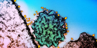 Symptoms of deadly virus with no cure and ‘epidemic potential’ as Covid-style checks introduced by airports