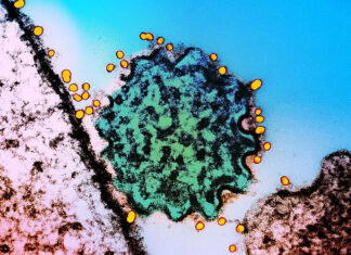 Symptoms of deadly virus with no cure and ‘epidemic potential’ as Covid-style checks introduced by airports