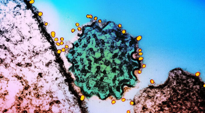 Symptoms of deadly virus with no cure and ‘epidemic potential’ as Covid-style checks introduced by airports
