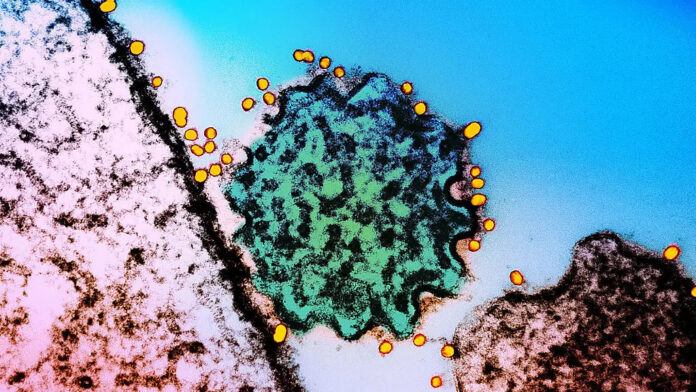 Symptoms of deadly virus with no cure and ‘epidemic potential’ as Covid-style checks introduced by airports