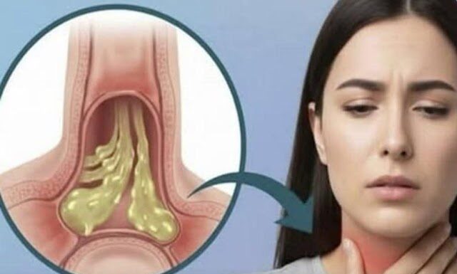 Clearing throat phlegm the safe way: proven methods that help