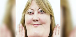 The incredible story of Victoria Wright: She inspires millions with her rare genetic condition
