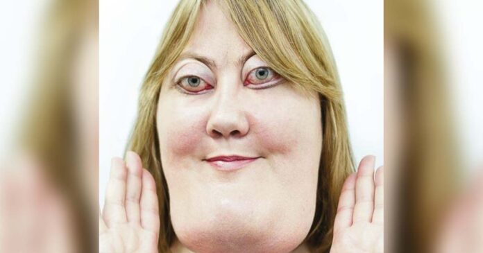 The incredible story of Victoria Wright: She inspires millions with her rare genetic condition