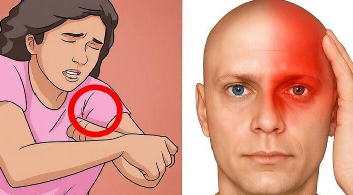 Warning signs of stroke your body might be sending