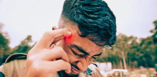 If you hit your head, watch out for these symptoms that can show up even days later