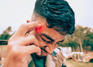 If you hit your head, watch out for these symptoms that can show up even days later