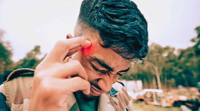 If you hit your head, watch out for these symptoms that can show up even days later