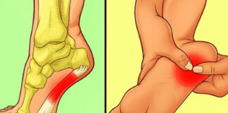 7 effective exercises to reduce heel pain and manage plantar fasciitis naturally