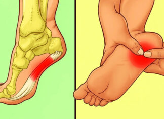 7 effective exercises to reduce heel pain and manage plantar fasciitis naturally
