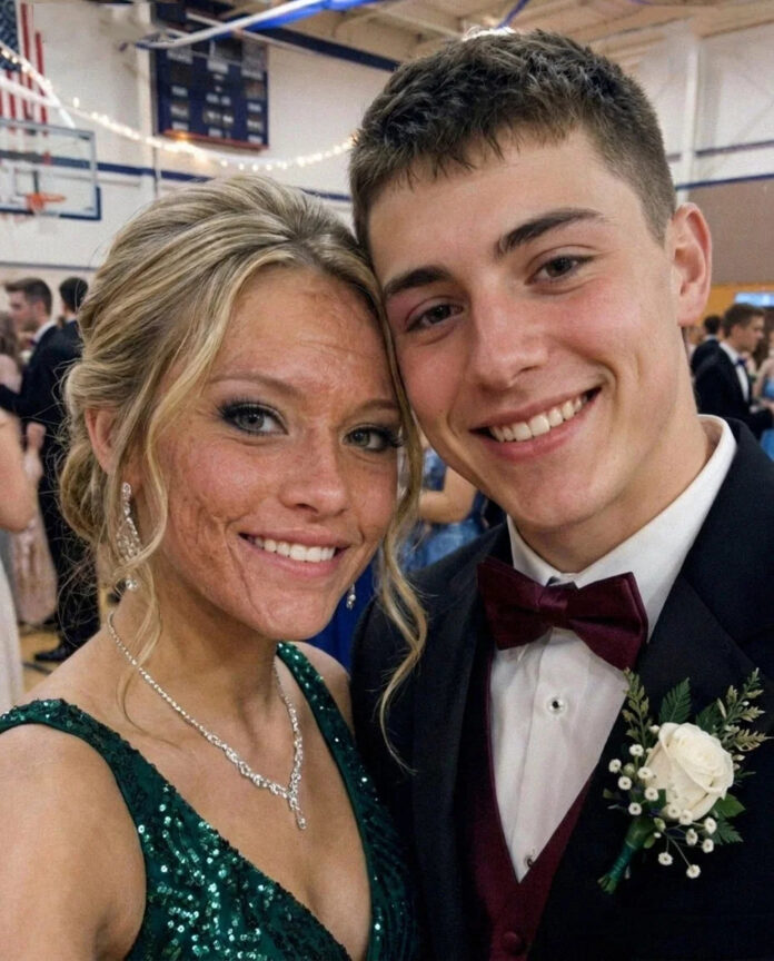 A boy took me to prom out of pity for my scars — the next day, his parents and police came to my door