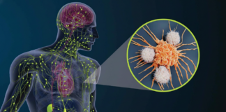 What role does the lymphatic system play in cancer progression?