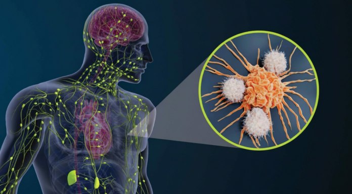 What role does the lymphatic system play in cancer progression?