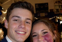 I was the only girl without a prom date because of my birthmark until one boy asked me — then police officers walked into the gym