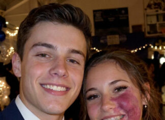 I was the only girl without a prom date because of my birthmark until one boy asked me — then police officers walked into the gym
