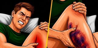 What causes night cramps and how to fix the problem