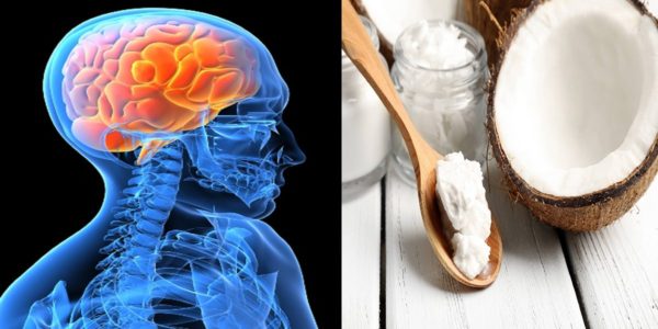 Could eating 2 tablespoons of coconut oil twice a day affect the brain?