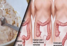 How 2 simple ingredients may help clear built-up waste from the intestines