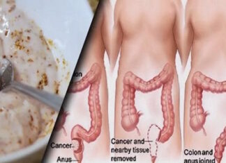 How 2 simple ingredients may help clear built-up waste from the intestines