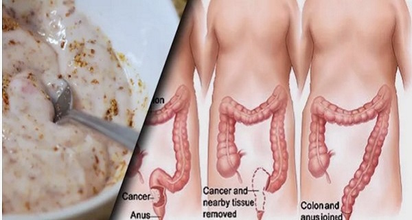 How 2 simple ingredients may help clear built-up waste from the intestines